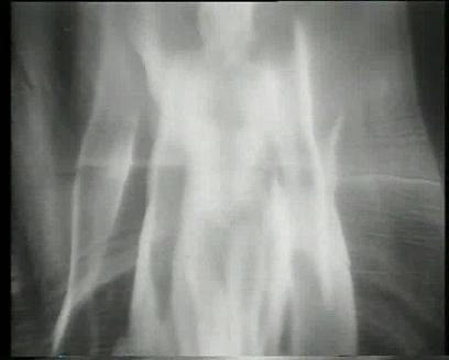 死亡观