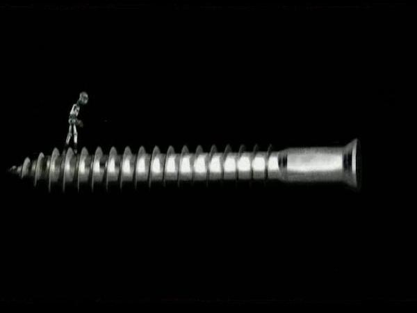 Metalstasis