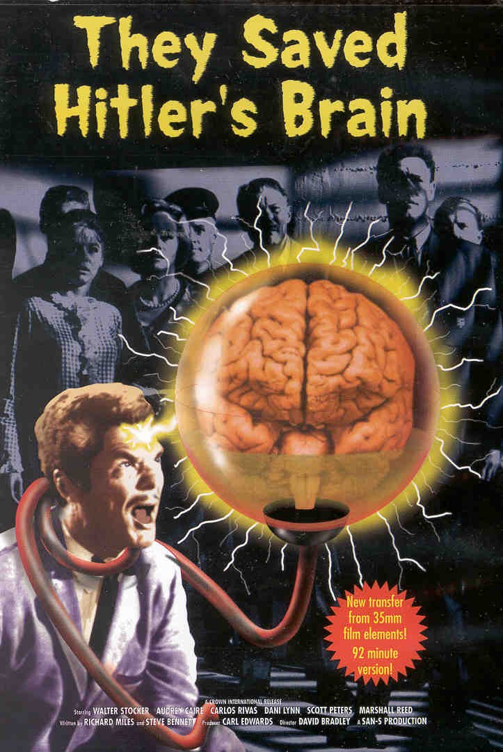 They Saved Hitler's Brain