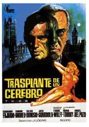 Trasplante de un cerebro