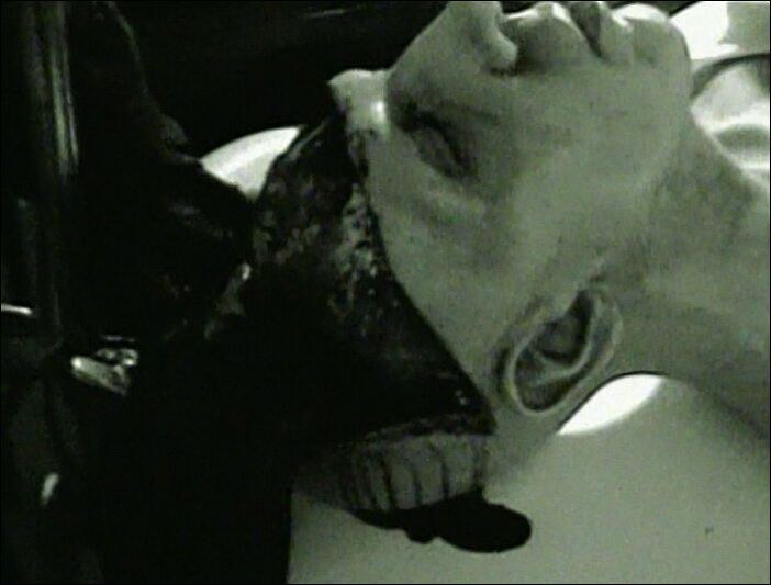 Autopsy